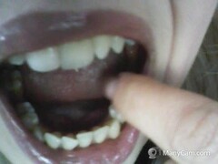 very ugly teeth! denti orribili Thumb